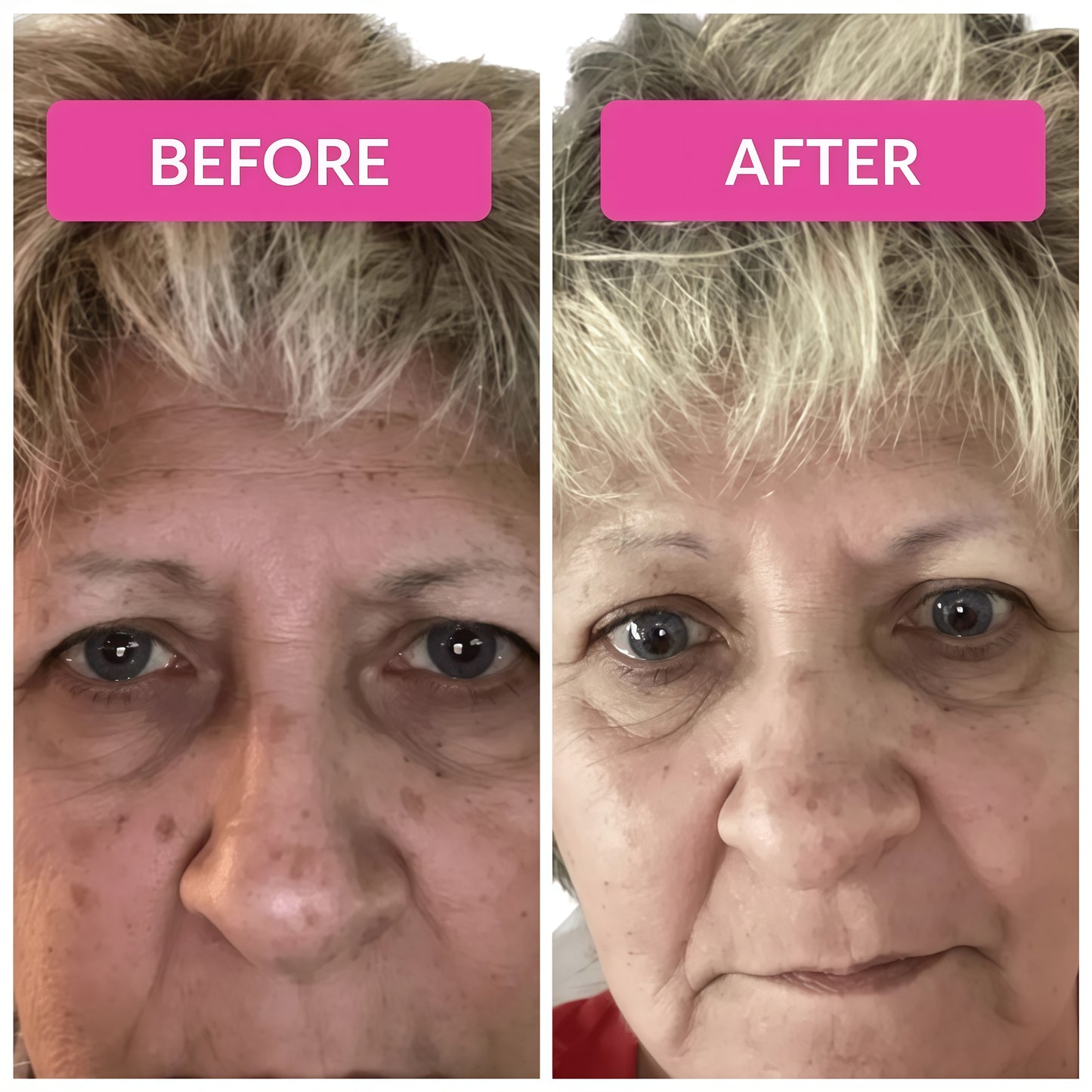 Visbiome GI Care