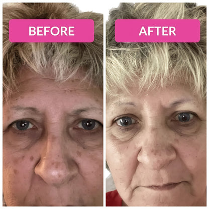 Visbiome GI Care